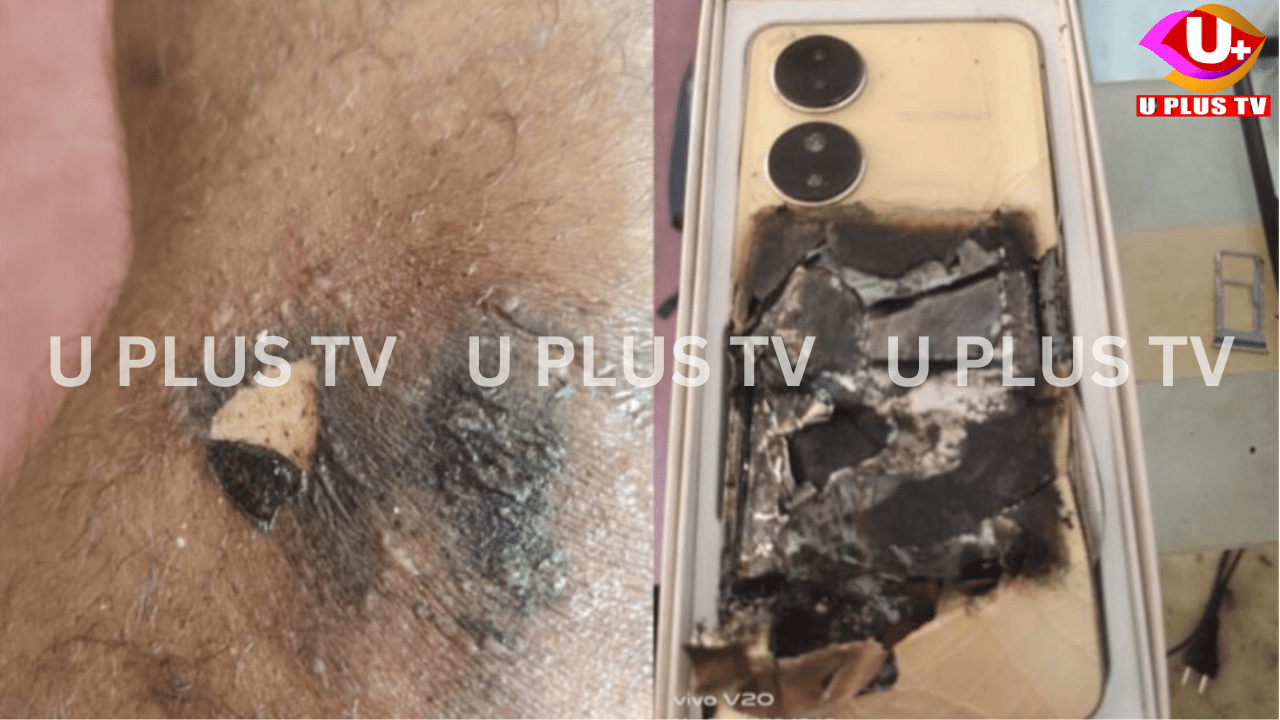 Sullia: ಕಲ್ಮಕಾರಿನಲ್ಲಿ ಮೊಬೈಲ್ ಸ್ಫೋಟ – ಯುವಕನಿಗೆ ಗಂಭೀರ ಗಾಯ!